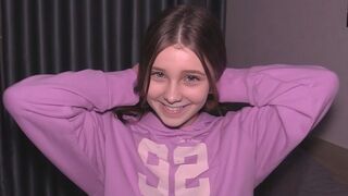 18-letý dospívající díra je silně rozšířena